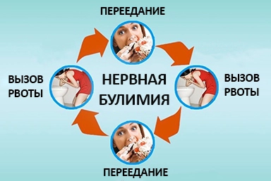 Лечение булимии в Барановичах